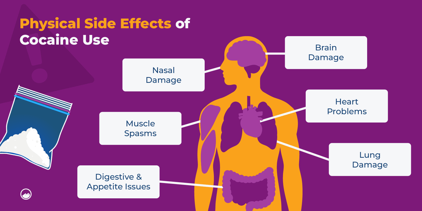 a diagram of the physical side effects of cocaine use