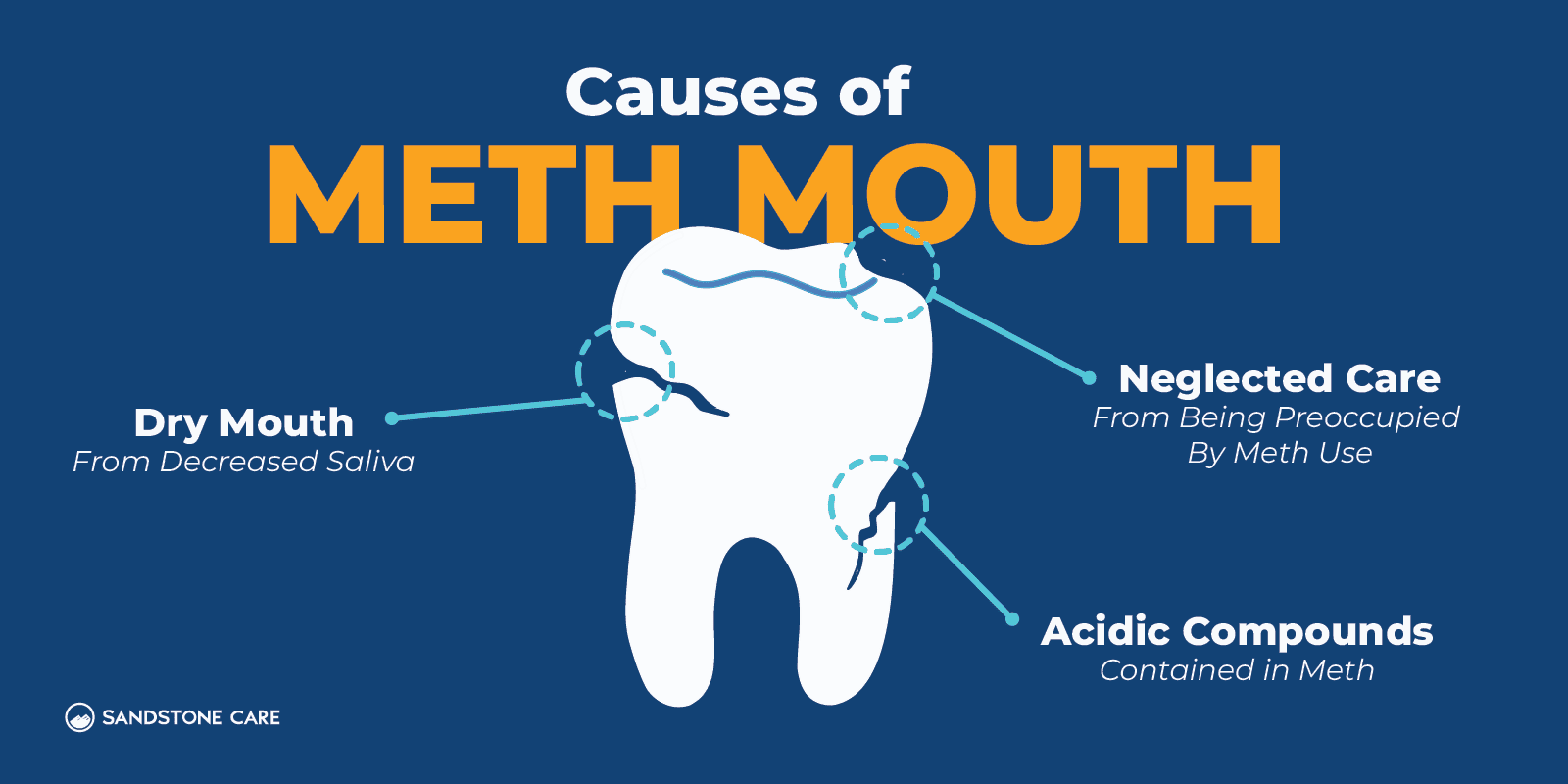 a diagram of the causes of meth mouth