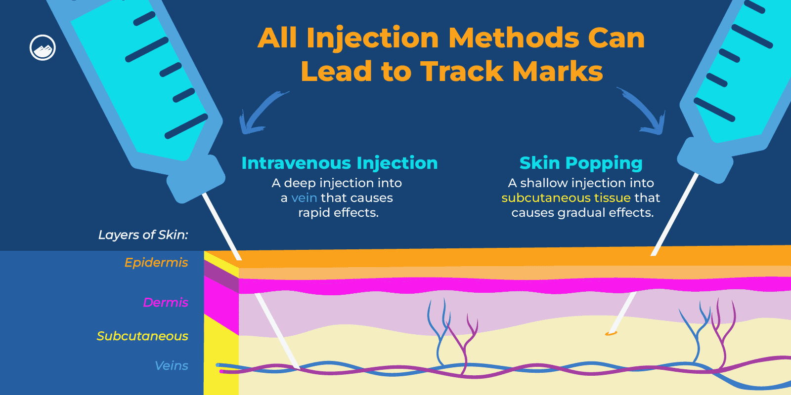a diagram of a procedure for injection methods to treat skin