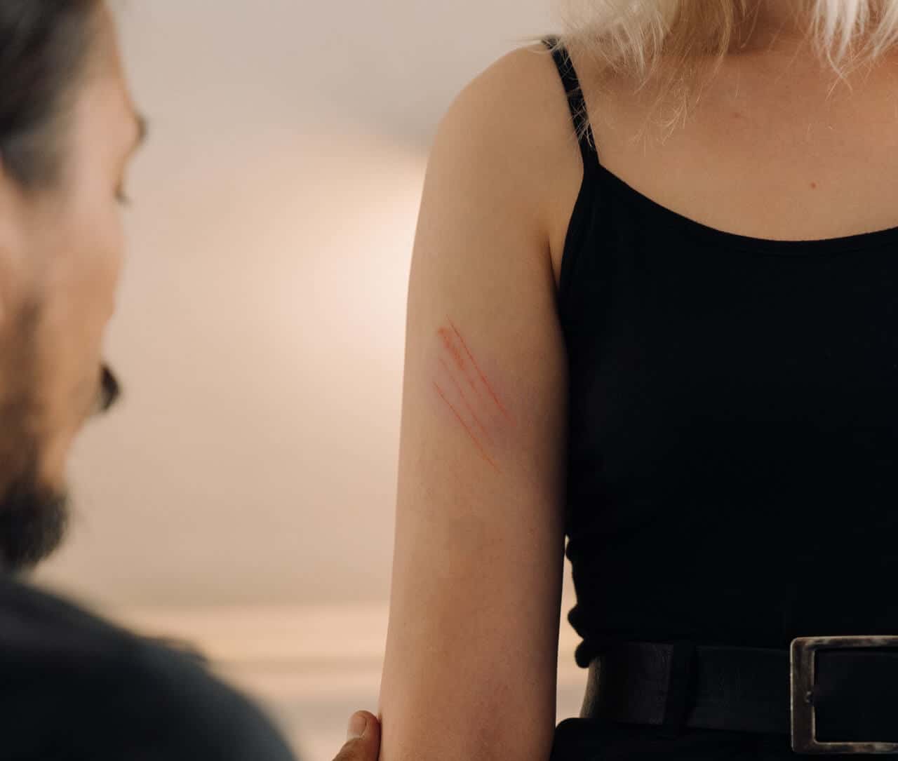 11 Things You Need To Know About Self-Harm In Teens